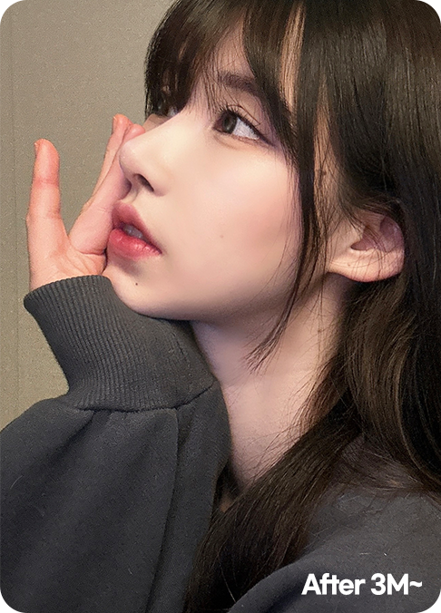 디에이 올아이 리프팅