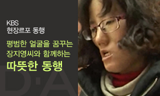 [KBS 현장르포 동행] 평범한 얼굴을 꿈꾸는 장지영씨와 함께하는 따뜻한 동행