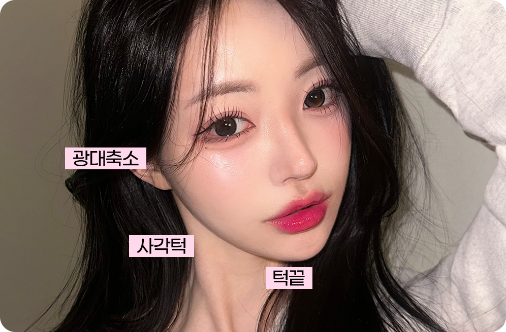 디에이 코 재수술