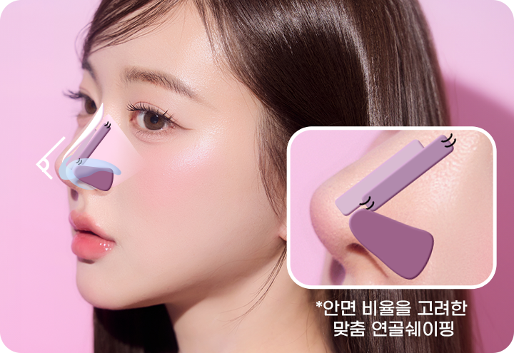 디에이 코 재수술