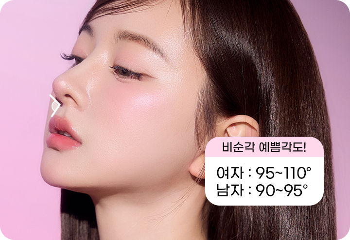 디에이 코 재수술