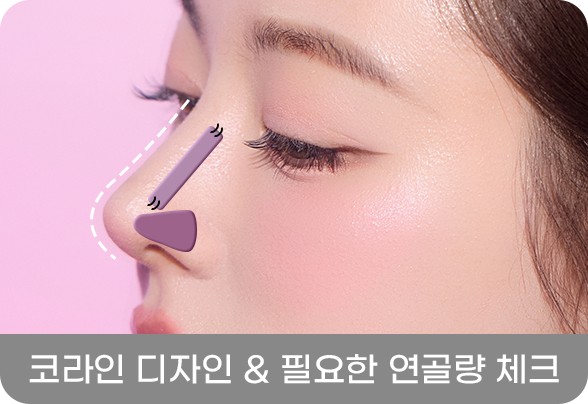 디에이 코 재수술