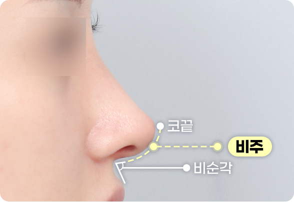 디에이 자려한코성형