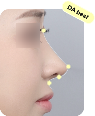 디에이 자려한코성형 비주 길이 컨트롤 CASE