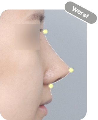 디에이 자려한코성형 비주 길이 컨트롤 CASE