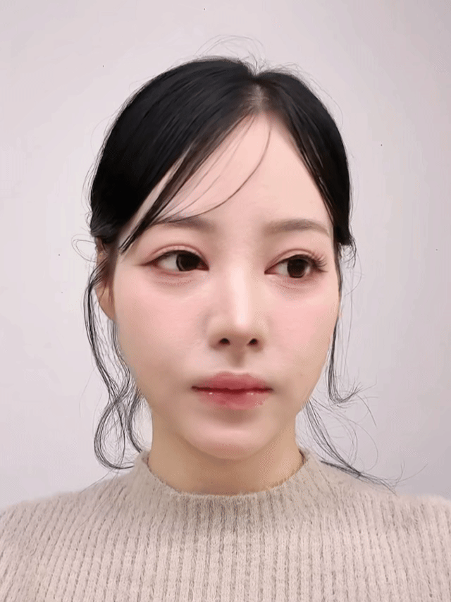 디에이 자려한코성형 비주 길이 컨트롤 CASE