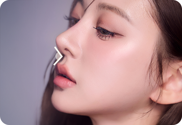 디에이 자려한코성형 비순각 예쁨각도