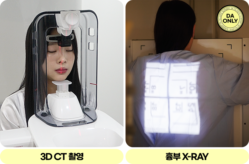 디에이 촬영 영상