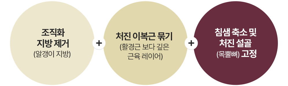 이중턱 삭제술