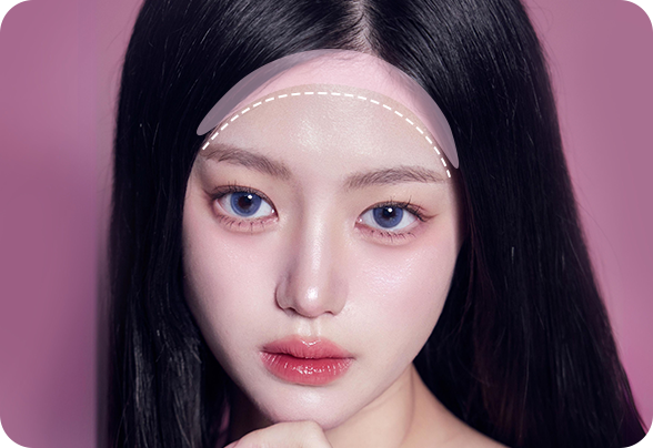 디에이