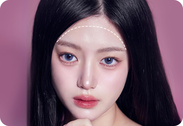 디에이