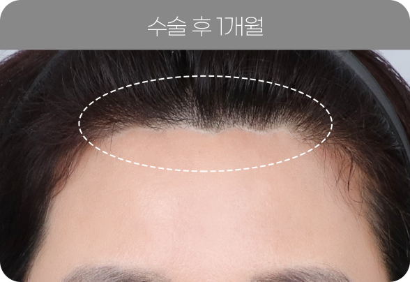 디에이