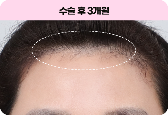 디에이