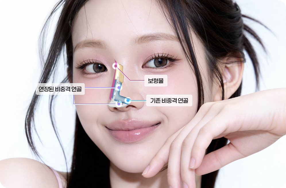 디에이 각도 코성형