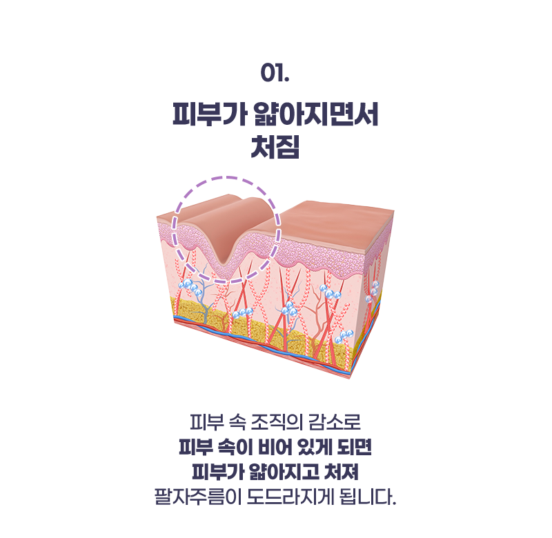 팔자특화 리프팅