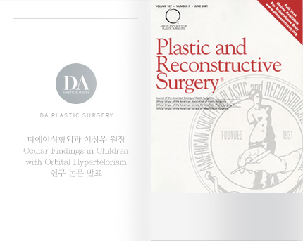 [논문발표] 이상우 원장, 'Ocular Findings in Children with Orbital Hypertelorism' 연구 논문 발표