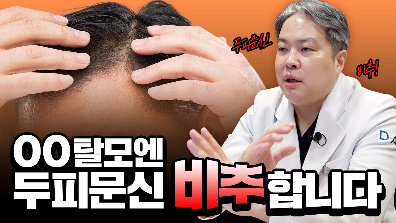 두피 문신 후회하는 이유?!