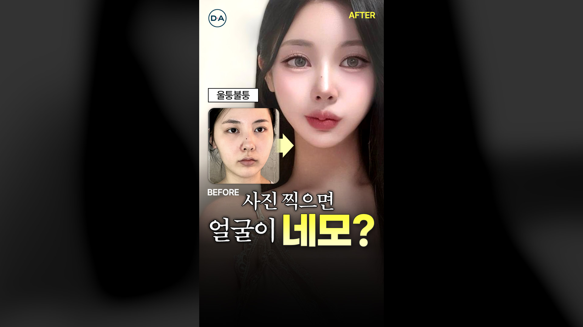 윤곽