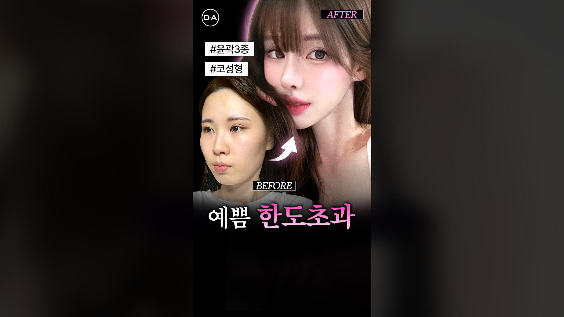 윤곽+눈+코
